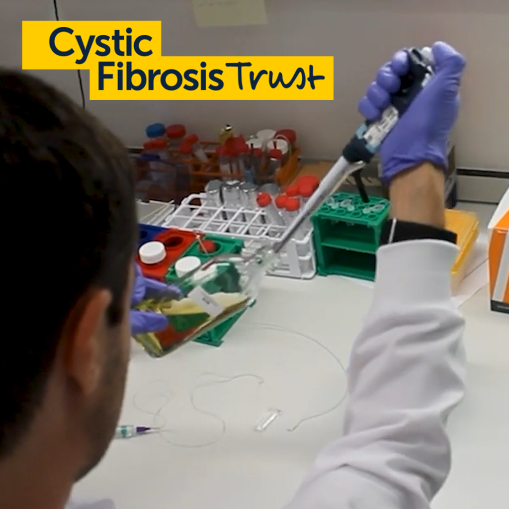 World class researchers with very different expertise are coming together to help improve the lives of people living with cystic fibrosis, thanks to the ongoing support from AJN Steelstock.